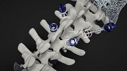 nvidia-propio-vision-precision-surgery Image